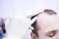Junger Mann mit Plasma-Reapplikation in der Kopfhaut zur Trichologie-Behandlung, Nahaufnahme. — Stockfoto
