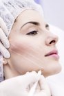 Dermatologo disegno segni sulla faccia della donna per thread-lift, primo piano
. — Foto stock