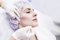 Dermatologo disegno segni sulla faccia della donna per thread-lift, primo piano . — Foto stock