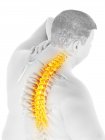 Close-up of overweight male with back pain, conceptual illustration. — Stock Photo