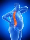 Corpo masculino obeso com dor nas costas, ilustração digital . — Fotografia de Stock