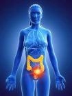 Silueta femenina con cáncer en el intestino grueso, ilustración digital . - foto de stock