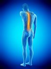 Rückansicht des männlichen Körpers mit Rückenschmerzen, konzeptionelle Illustration. — Stockfoto