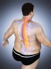 Obese male body with back pain in high angle view, digital illustration. — Stock Photo