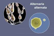 Ilustración digital de la morfología fúngica del hongo alergénico filamentoso Alternaria alternata y fotografía de colonias fúngicas en Sabouraud Dextrosa Agar
. - foto de stock