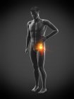 Silhouette dell'uomo con dolore all'anca, illustrazione digitale . — Foto stock