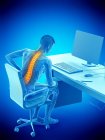 Silhouette d'un employé de bureau souffrant de maux de dos dus à sa position assise, illustration conceptuelle . — Photo de stock