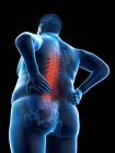 Obese male body with back pain in low angle view, digital illustration. — Stock Photo
