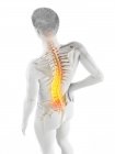 Cuerpo masculino con dolor de espalda en vista de ángulo alto, ilustración conceptual . - foto de stock