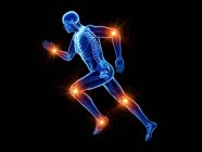Runner silhouette with places of joint pain, conceptual computer illustration. — Stock Photo