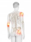 Menschlicher Körper mit Gelenkschmerzen, konzeptionelle Illustration. — Stockfoto
