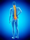 Мужской силуэт с болью в спине на синем фоне, концептуальная иллюстрация . — стоковое фото