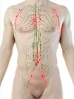 Ganglions lymphatiques élargis dans le corps masculin, illustration conceptuelle de l'ordinateur . — Photo de stock