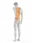Rückansicht des männlichen Körpers mit Rückenschmerzen, konzeptionelle Illustration. — Stockfoto