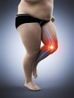 Silhouette di corridore obeso maschio con dolore al ginocchio, illustrazione digitale concettuale . — Foto stock