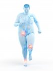 Silhouette de l'homme obèse en cours d'exécution avec douleurs articulaires, illustration informatique . — Photo de stock