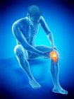 Силуэт сидящего человека с болью в колене, концептуальная иллюстрация . — стоковое фото