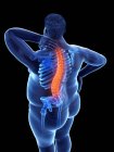 Cuerpo masculino obeso con dolor de espalda en vista de ángulo alto, ilustración digital . - foto de stock
