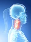 Абстрактное женское тело с подробной болью в шее, концептуальная цифровая иллюстрация . — стоковое фото