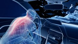 Рентгеновская иллюстрация риска травмы позвоночника при лобовой автокатастрофе, цифровые произведения искусства . — стоковое фото