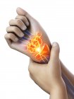Mains humaines abstraites avec douleur au poignet, illustration conceptuelle . — Photo de stock