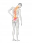 Вид сзади мужского тела с болью в спине, концептуальная иллюстрация . — стоковое фото