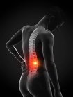 Silueta masculina con dolor de espalda sobre fondo negro, ilustración conceptual . - foto de stock
