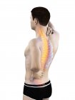 Silueta masculina con dolor de espalda, ilustración conceptual
. - foto de stock