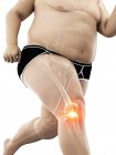 Silhouette eines übergewichtigen Läufers mit Knieschmerzen, konzeptionelle digitale Illustration. — Stockfoto