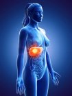 Жіночий силует з пухлиною в печінці на синьому фоні, комп'ютерна ілюстрація . — стокове фото