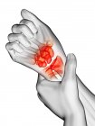 Abstrakte menschliche Hände mit Handgelenkschmerzen, konzeptionelle Illustration. — Stockfoto