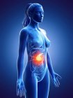 Рак підшлункової залози у жіночому тілі, концептуальна комп'ютерна ілюстрація . — стокове фото