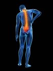 Vista posteriore del corpo maschile con infiammazione e mal di schiena, illustrazione concettuale . — Foto stock