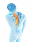 Silhouette maschile con mano sull'infiammazione del mal di schiena, illustrazione concettuale . — Foto stock