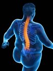 Fettleibige männliche Körper mit Rückenschmerzen in Hochwinkelansicht, digitale Illustration. — Stockfoto