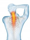 Corpo maschile in vista posteriore con dolore al collo visibile, illustrazione concettuale . — Foto stock