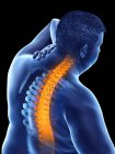 Close-up of overweight male with back pain, conceptual illustration. — Stock Photo