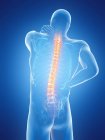 Male body with back pain on blue background, digital illustration. — Stock Photo