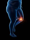 Силуэт мужского толстого бегуна с болью в колене, концептуальная цифровая иллюстрация . — стоковое фото