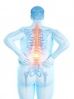 Obese male body with back pain, digital illustration. — Stock Photo