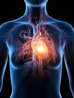 Серцевий приступ у людському тілі.. — Stock Photo