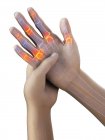 Manos humanas abstractas con dolor en los dedos, ilustración conceptual . - foto de stock