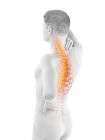Silhueta masculina com dor nas costas, ilustração conceitual . — Fotografia de Stock