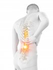 Silhueta masculina com dor nas costas em fundo branco, ilustração conceitual . — Fotografia de Stock