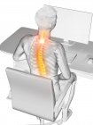Office worker with back pain in high angle view, conceptual illustration. — Stock Photo