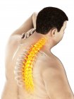 Close-up of overweight male with back pain, conceptual illustration. — Stock Photo