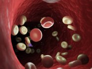 Células sanguíneas enfermas con bacterias, ilustración por computadora . - foto de stock