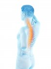 Мужской силуэт с болью в спине, концептуальная иллюстрация . — стоковое фото