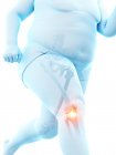 Silhueta de corredor obeso masculino com dor no joelho, ilustração digital conceitual . — Fotografia de Stock