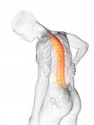 Flexión silueta masculina con dolor de espalda, ilustración conceptual . - foto de stock